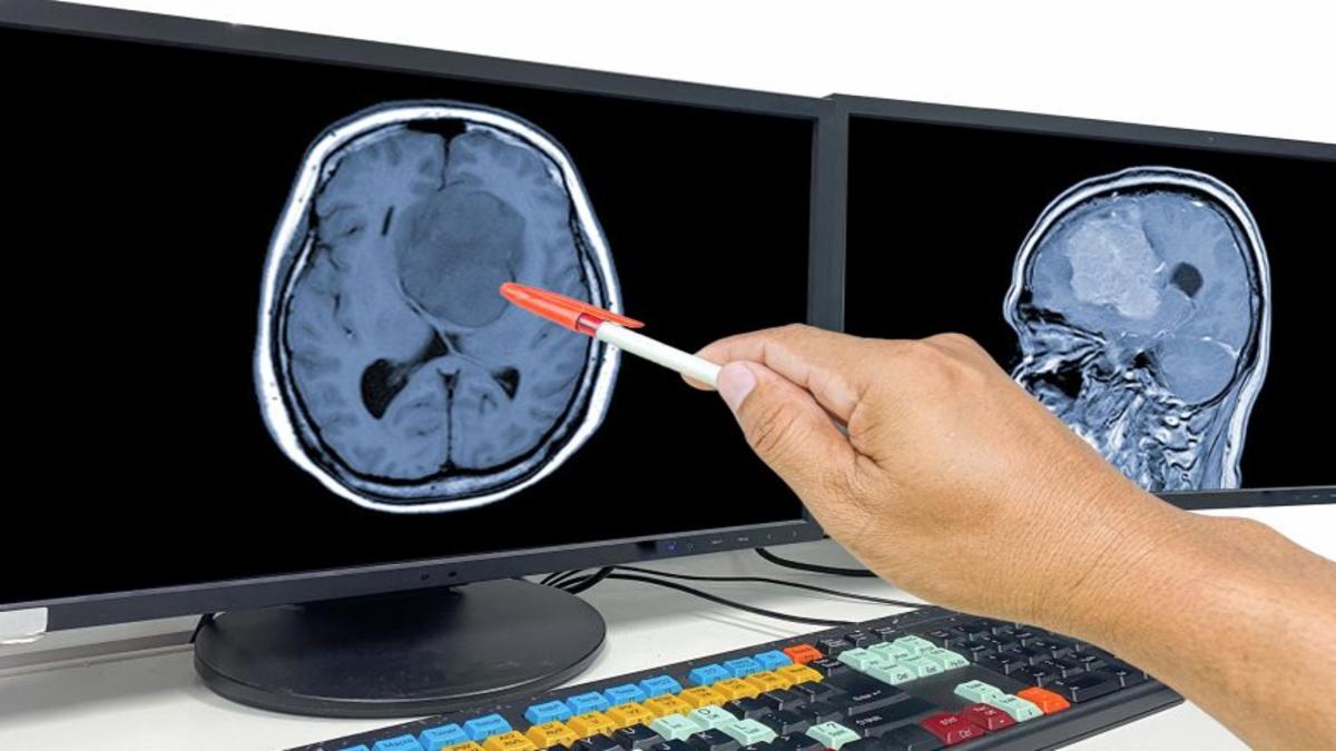 Breakthrough Trends in Glioblastoma Immunotherapy: A Data-Centered Look